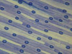 Surface inférieure d’une feuille vue au microscope électronique à balayage